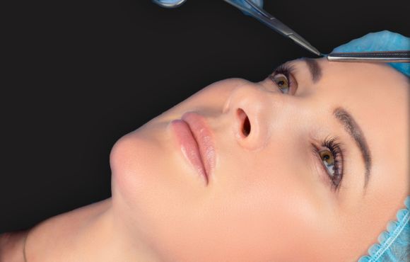 Blefaroplastia